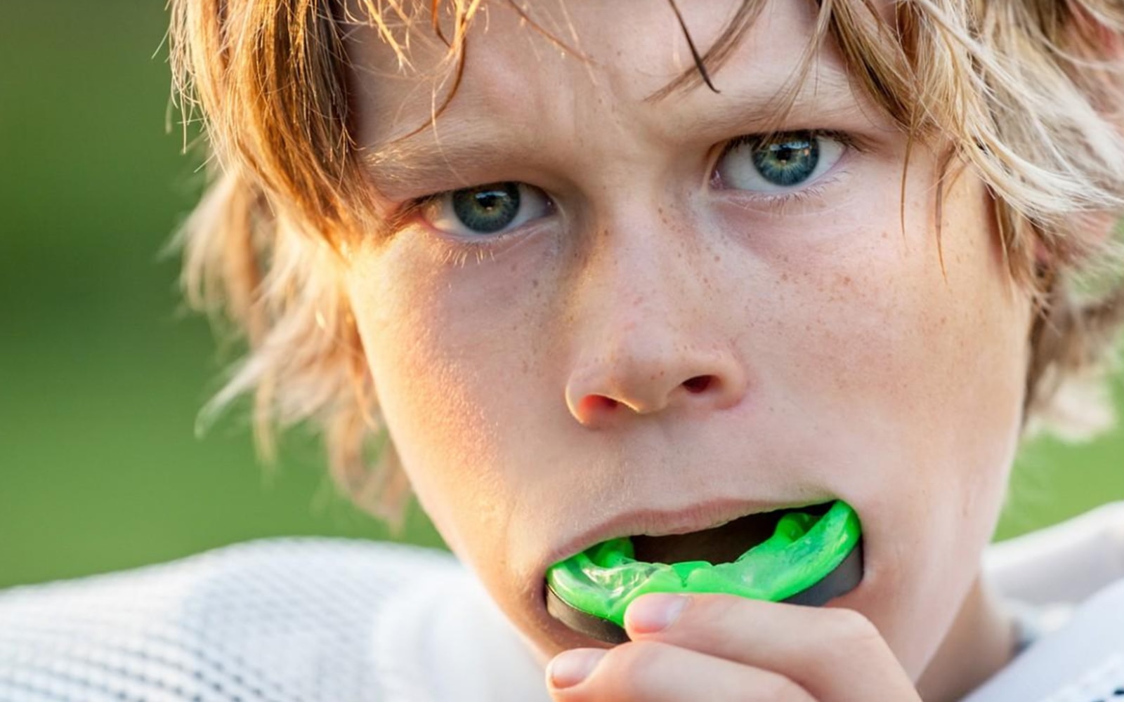 Que faire en cas de traumatisme dentaire en sport ? - Dr GESSIER