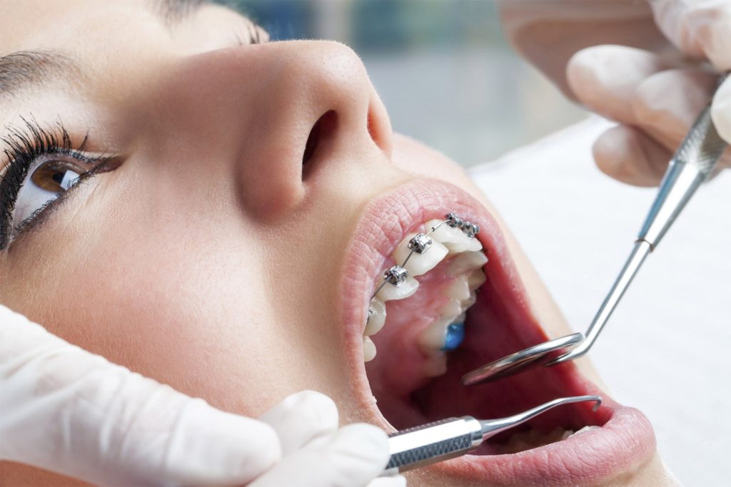 L’orthodontie en quelques mots - Dr GESSIER